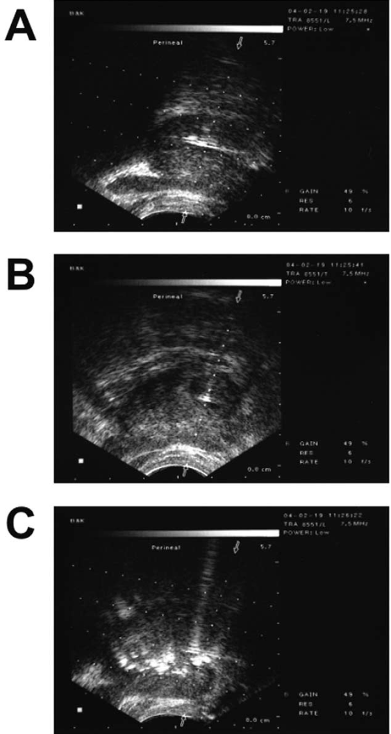 Uro_Fig_4_Chuang